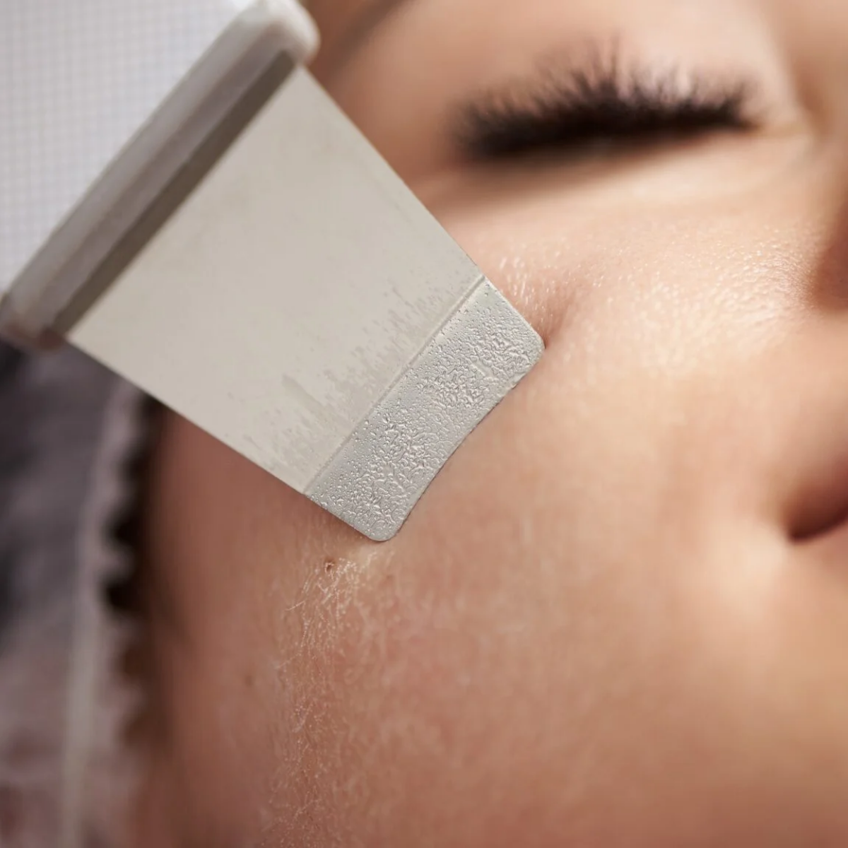 Skin scrubber - Limpia, extrae y mejora la absorción en un solo equipo